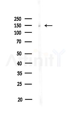 UBE4B Antibody - Western blot analysis of lysates from Rat brain, using UBE4B Antibody at 1/1000 dilution.