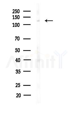 UBE4B Antibody - Western blot analysis of lysates from Hela cells(heat-shock,45min treatment), using UBE4B Antibody at 1/1000 dilution.
