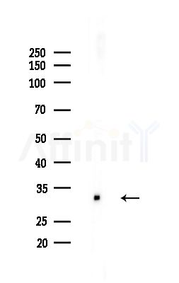 OTUB1 Antibody - Western blot analysis of lysates from EC304 cells, using OTUB1 Antibody at 1/1000 dilution.