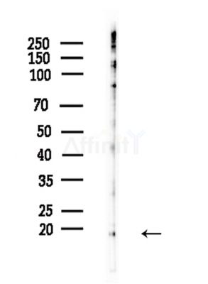 UBE2A/B Antibody - Western blot analysis of lysates from Hela cells(LPS,4h treatment), using UBE2A/B Antibody at 1/1000 dilution.
