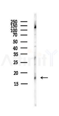 FUNDC1 Antibody - Western blot analysis of lysates from HepG2 cells(starvation,24h treatment), using FUNDC1 Antibody at 1/1000 dilution.