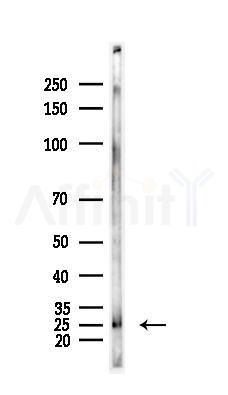 CacyBP Antibody - Western blot analysis of lysates from Hela cells(heat-shock,45min treatment), using CacyBP Antibody at 1/1000 dilution.