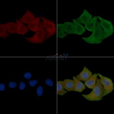 Phospho-EPHA2/3/4 (Tyr588/Tyr596) Antibody - AF0028 staining Hela cells(30min of UV treatment) by IF/ICC.