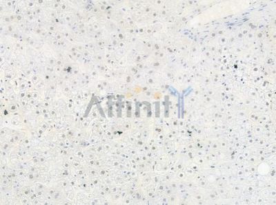Phospho-hnRPD (Ser83) Antibody - AF0033 at 1/100 staining human normal liver tissue by IHC-P.