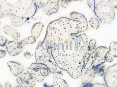 Phospho-hnRPD (Ser83) Antibody - AF0033 at 1/100 staining human normal placenta tissue by IHC-P.