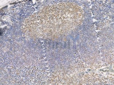Phospho-hnRPD (Ser83) Antibody - AF0033 at 1/100 staining human normal tonsil tissue by IHC-P.