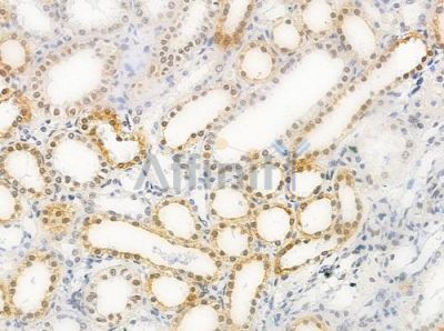 Phospho-hnRPD (Ser83) Antibody - AF0033 at 1/100 staining human normal kidney tissue by IHC-P.