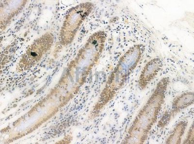 Phospho-hnRPD (Ser83) Antibody - AF0033 at 1/100 staining human normal colon tissue by IHC-P.