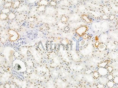 Phospho-hnRPD (Ser83) Antibody - AF0033 at 1/100 staining human normal kidney tissue by IHC-P.