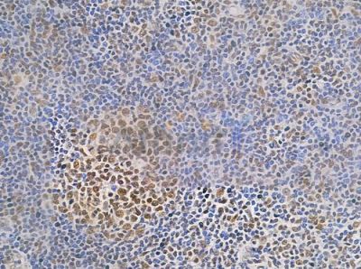 Phospho-hnRPD (Ser83) Antibody - AF0033 at 1/100 staining human normal tonsil tissue by IHC-P.