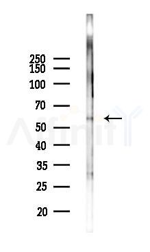Phospho-RIPK2 (Ser176) Antibody - Western blot analysis of lysates from HUVEC cells(starvation,24h treatment), using Phospho-RIPK2 (Ser176) Antibody at 1/1000 dilution.