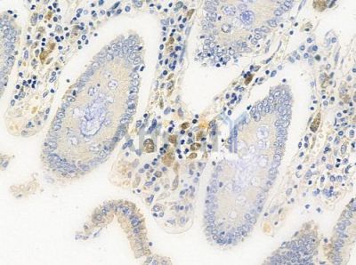 Phospho-Gab2 (Tyr452) Antibody - AF0059 at 1/100 staining human normal colon tissue by IHC-P.
