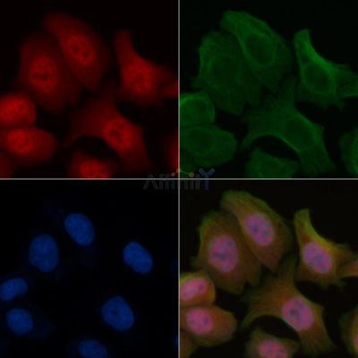Phospho-5 Lipoxygenase (Ser523) Antibody - AF0064 staining Hela cells by IF/ICC.