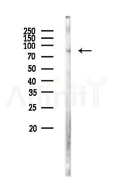 CD31 Antibody - Western blot analysis of lysates from Rat brain, using CD31 Antibody at 1/1000 dilution.