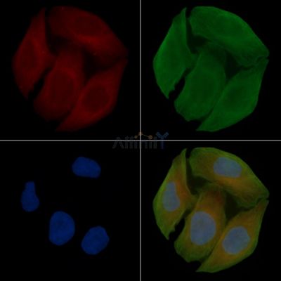 MCSF Receptor Antibody - AF0080 staining Hela cells(30min of UV treatment) by IF/ICC.