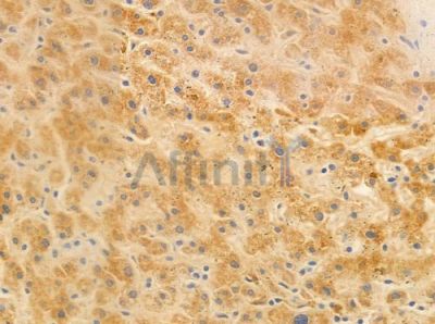 IL-2R beta/CD122 Antibody - AF0093 at 1/100 staining human normal liver tissue by IHC-P.