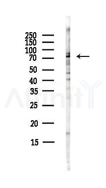 Annexin A6 Antibody - Western blot analysis of lysates from HepG2 cells(starvation,24h treatment), using Annexin A6 Antibody at 1/1000 dilution.