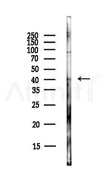 APAF1 Antibody - Western blot analysis of lysates from HepG2 cells(LPS,4h treatment), using APAF1 Antibody at 1/1000 dilution.