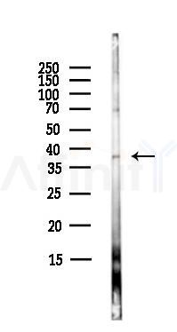 APAF1 Antibody - Western blot analysis of lysates from HepG2 cells(starvation,24h treatment), using APAF1 Antibody at 1/1000 dilution.