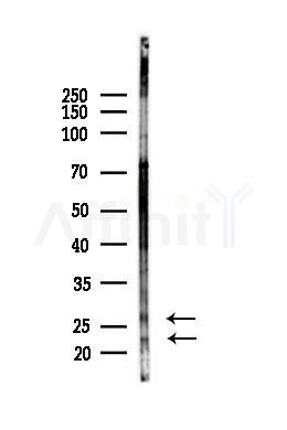Bim Antibody - Western blot analysis of lysates from Mouse liver, using Bim Antibody at 1/1000 dilution.