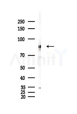 Catenin gamma Antibody - Western blot analysis of lysates from Hela cells(heat-shock,45min treatment), using Catenin gamma Antibody at 1/1000 dilution.