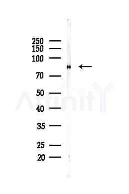 Catenin gamma Antibody - Western blot analysis of lysates from Mouse liver, using Catenin gamma Antibody at 1/1000 dilution.