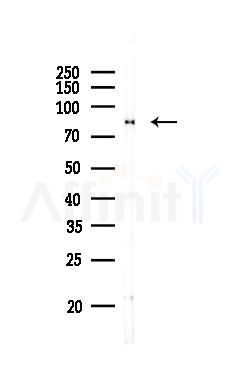 Catenin gamma Antibody - Western blot analysis of lysates from 3T3-L1 P6, using Catenin gamma Antibody at 1/1000 dilution.