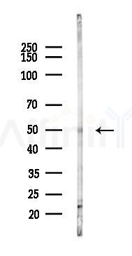 Cyclin E1 Antibody - Western blot analysis of lysates from B16F10-LUC cells(starvation,24h treatment), using Cyclin E1 Antibody at 1/1000 dilution.