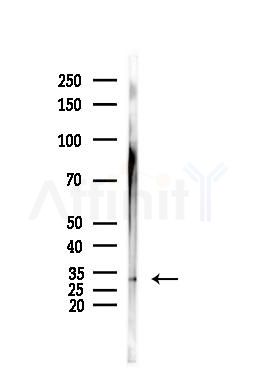 E2F6 Antibody - Western blot analysis of lysates from Hela cells(heat-shock,45min treatment), using E2F6 Antibody at 1/1000 dilution.