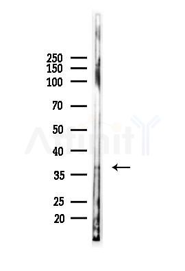 ERCC1 Antibody - Western blot analysis of lysates from Mouse liver, using ERCC1 Antibody at 1/1000 dilution.