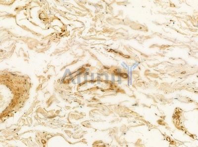 Factor VIII Antibody - AF0156 at 1/100 staining human normal colon tissue by IHC-P.