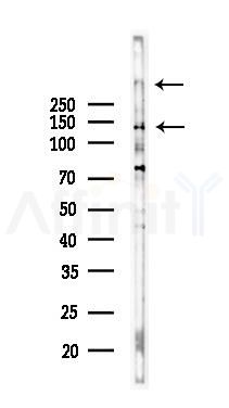 Factor VIII Antibody - Western blot analysis of lysates from 293 cells(heat-shock,45min treatment), using Factor VIII Antibody at 1/1000 dilution.
