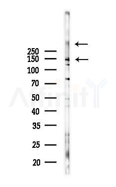 Factor VIII Antibody - Western blot analysis of lysates from Hela cells(heat-shock,45min treatment), using Factor VIII Antibody at 1/1000 dilution.