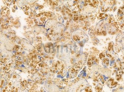 FGFR2 Antibody - AF0159 at 1/100 staining human normal placenta tissue by IHC-P.