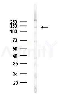 FGFR2 Antibody - Western blot analysis of lysates from Hela cells(LPS, 4h treatment), using FGFR2 Antibody at 1/1000 dilution.