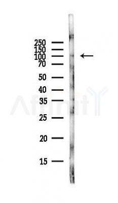 FGFR3 Antibody - Western blot analysis of lysates from Rat liver, using FGFR3 Antibody at 1/1000 dilution.