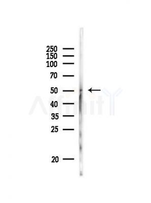 FLI1 Antibody - Western blot analysis of lysates from PC12 cells, using FLI1 Antibody at 1/1000 dilution.