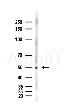 FLI1 Antibody - Western blot analysis of lysates from Hela cells(heat-shock,45min treatment), using FLI1 Antibody at 1/1000 dilution.
