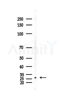 Galectin 3 Antibody - Western blot analysis of lysates from Hela cells(heat-shock,45min treatment), using Galectin 3 Antibody at 1/1000 dilution.
