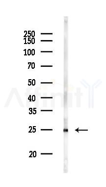 Glucagon Antibody - Western blot analysis of lysates from Mouse lung, using Glucagon Antibody at 1/1000 dilution.