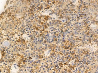 Grp75 Antibody - AF0176 at 1/100 staining human pituitary adenoma by IHC-P.