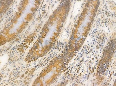 Grp75 Antibody - AF0176 at 1/100 staining human normal colon tissue by IHC-P.