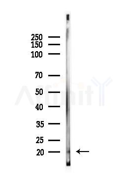 hCG beta Antibody - Western blot analysis of lysates from Mouse testis, using hCG beta Antibody at 1/1000 dilution.