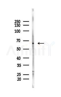 HDAC1 Antibody - Western blot analysis of lysates from PC12 cells, using HDAC1 Antibody at 1/1000 dilution.