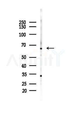 HDAC1 Antibody - Western blot analysis of lysates from HepG2 cells(starvation,24h treatment), using HDAC1 Antibody at 1/1000 dilution.