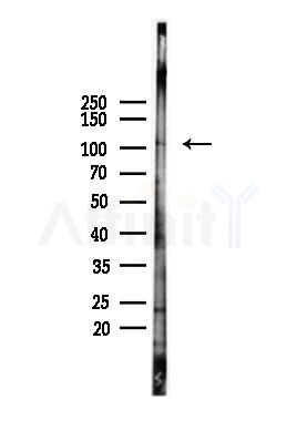 HDAC7 Antibody - Western blot analysis of lysates from HepG2 cells(starvation,24h treatment), using HDAC7 Antibody at 1/1000 dilution.