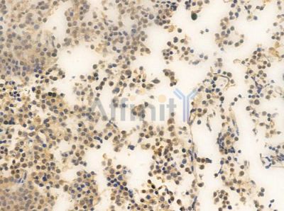 HDAC7 Antibody - AF0180 at 1/100 staining human pituitary adenoma by IHC-P.