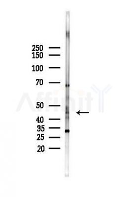 NRG1 Antibody - Western blot analysis of lysates from HepG2 cells(starvation,24h treatment), using NRG1 Antibody at 1/1000 dilution.