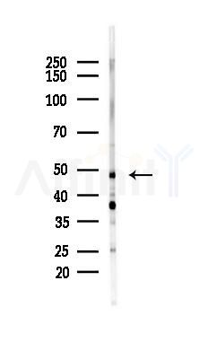 Cytokeratin 17 Antibody - Western blot analysis of lysates from HepG2 cells(starvation,24h treatment), using Cytokeratin 17 Antibody at 1/1000 dilution.