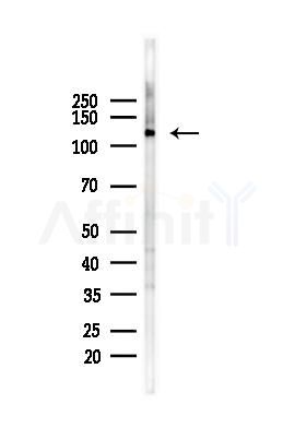 MCM2 Antibody - Western blot analysis of lysates from HepG2 cells(starvation,24h treatment), using MCM2 Antibody at 1/1000 dilution.